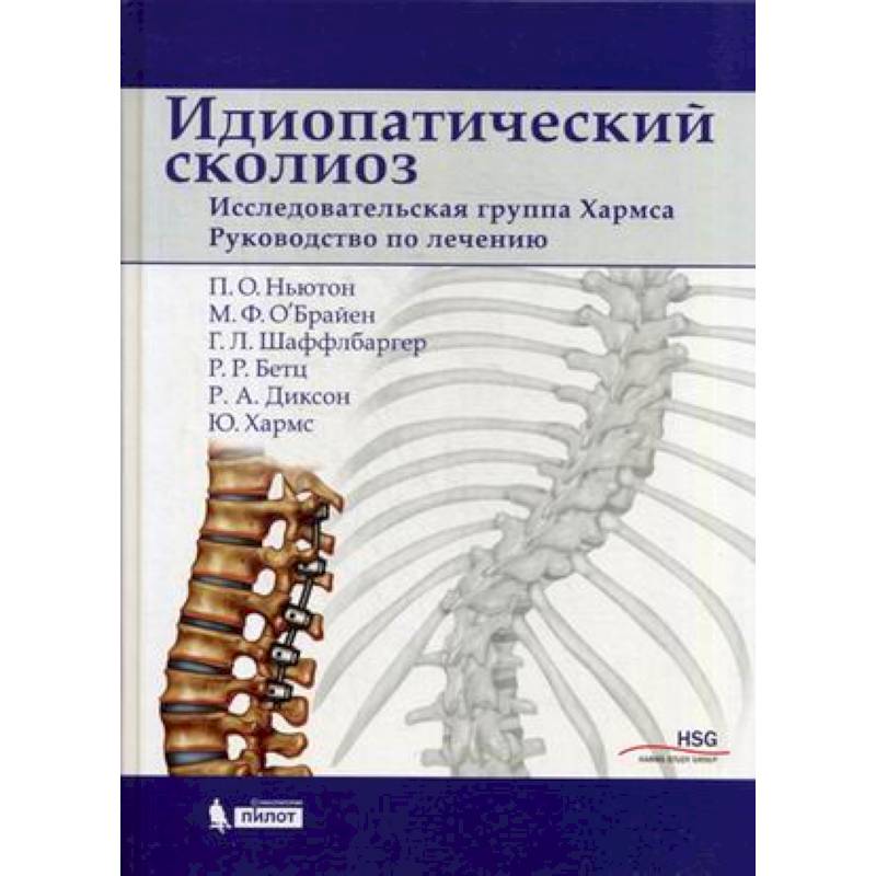 Идиопатический сколиоз. Исследовательская группа Хармса. Руководство по лечению