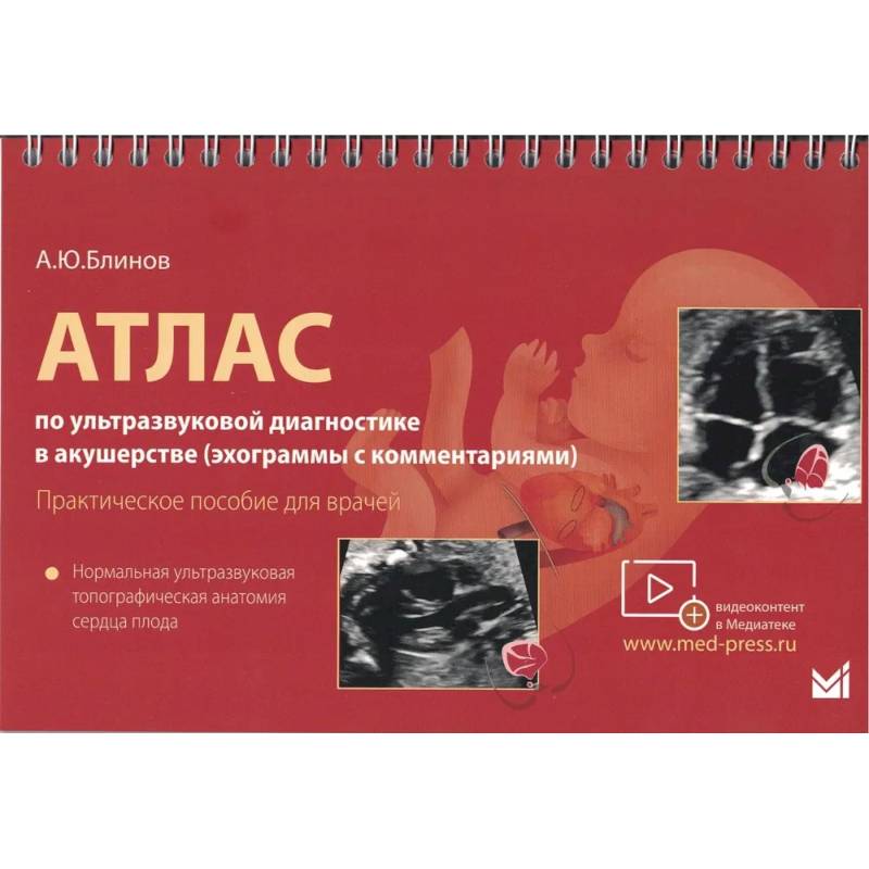 Атлас по УЗД в акушерстве. Нормальная ультразвуковая топографическая анатомия сердца плода: Практическое пособие для врачей