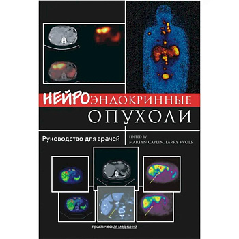 Нейроэндокринные опухоли. Руководство для врачей