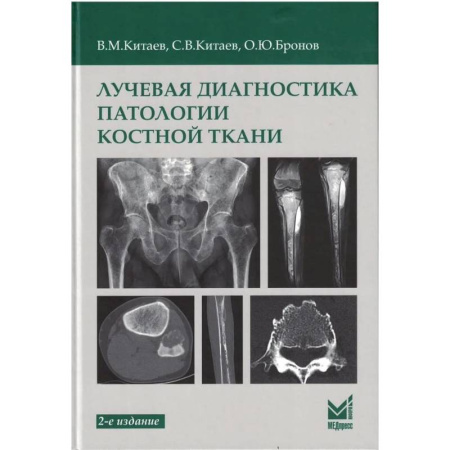 Медицинские энциклопедии и справочники, книга Лучевая диагностика патологии костной ткани купить по скидке