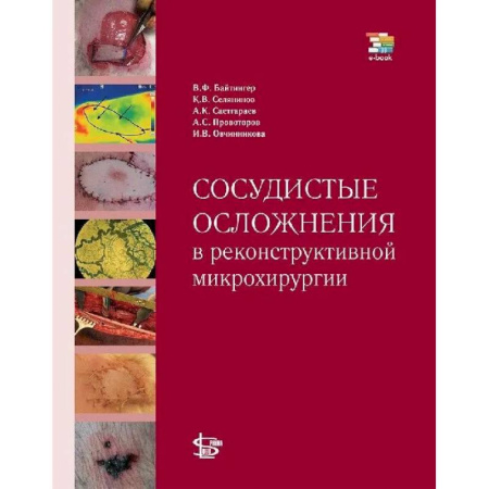 Хирургия. Ортопедия, книга Сосудистые осложнения в реконструктивной микрохирургии купить по скидке