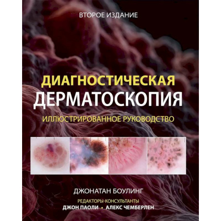 Кожные и венерические болезни, книга Диагностическая дерматоскопия: иллюстрированное руководство купить по скидке