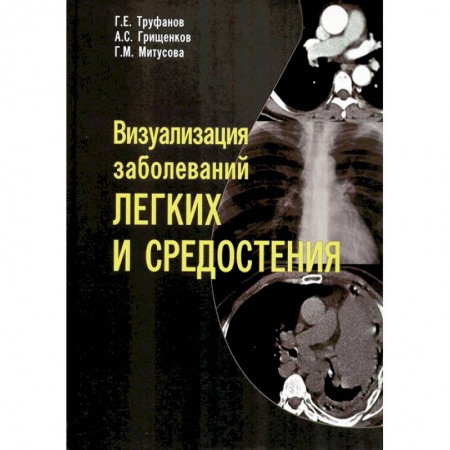 Органы дыхания. Туберкулез. Астма, книга Визуализация заболеваний легких и средостения купить по скидке